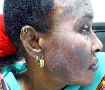 17-18-19-20-37-BLEACHING-7-2-15.