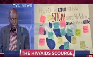 HIV AIDS
